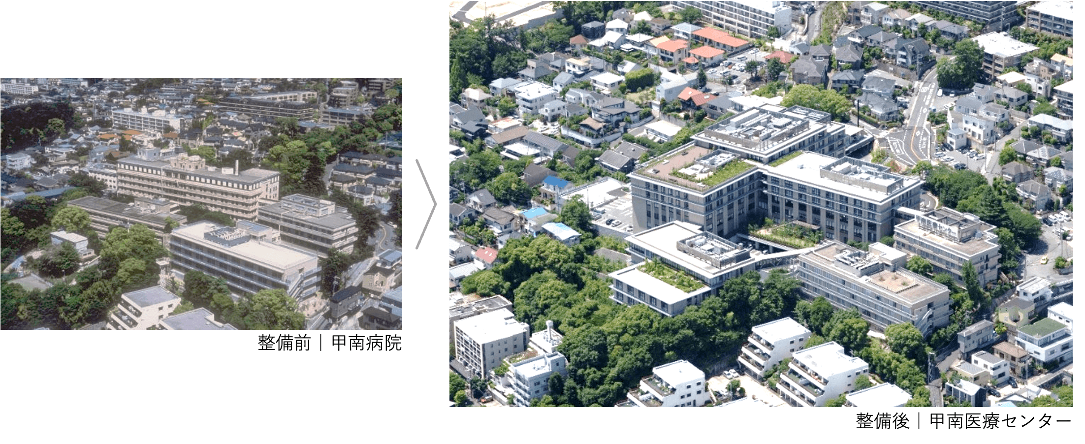整備前の甲南病院と整備後の甲南医療センターの航空写真比較